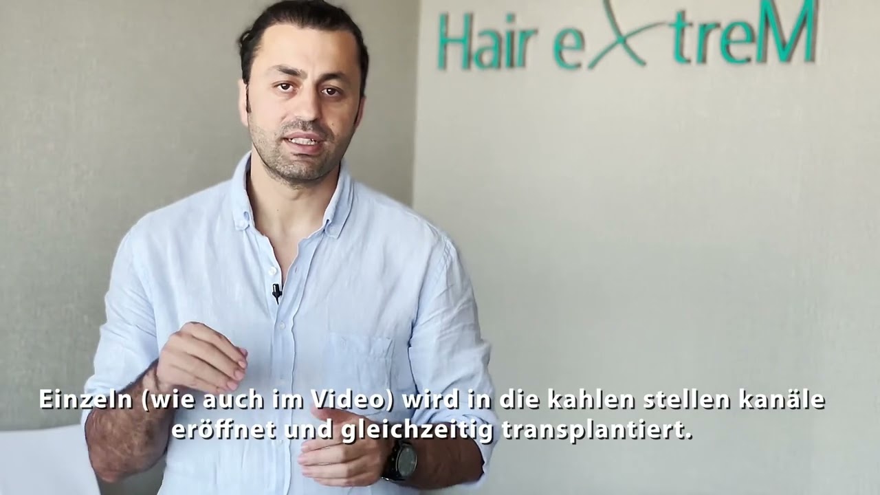 Weibliche Haartransplantation